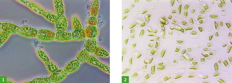 FOT. 1-2. Komórki glonów Trentepohlia sp. (1) oraz Stichococcus sp. (2) w powiększeniu mikroskopowym; fot.: [2]