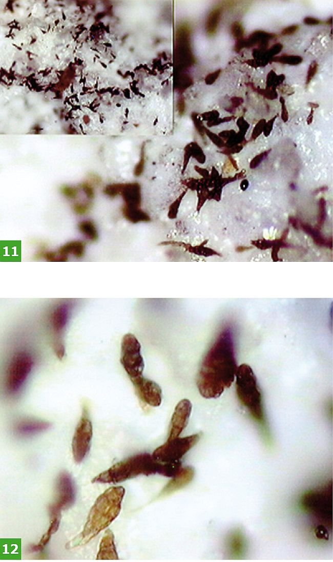 FOT. 11-12. Wyrost grzybów na powierzchni tynku w powiększeniu mikroskopowym; fot.: [5]