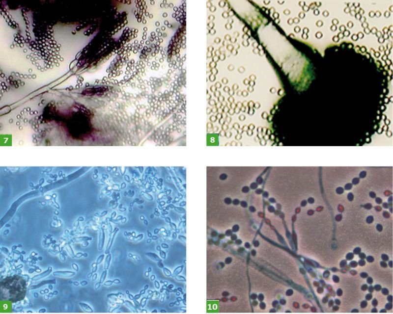 FOT. 7-10. Komórki grzybów: Penicilium sp. (7), Aspergillus sp. (8), Cladosporium cladosporiodes (9), Penicilium ochrochloron (10) w powiększeniu mikroskopowym; fot.: [4]