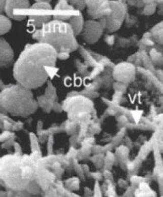 Fot. 5. Komórki bakterii baccillius pasteurii (cbc) w strukturze betonu
